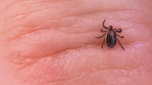 Fitness Guru's Paralysis: How a Tick Bite Turned a Healthy Life Upside Down – and What You Need to Know