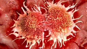 Vitamin C Deficiency Linked to Higher Risk of Stomach, Esophageal, and Lung Cancers: Key Symptoms to Watch For