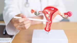 Headline:
Ovarian Cancer: Nutrition, Fitness, and Lifestyle Strategies for Enhanced Well-being