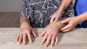 Swollen Fingers: 8 Common Causes, From Arthritis to Fluid Retention, and How to Treat Them