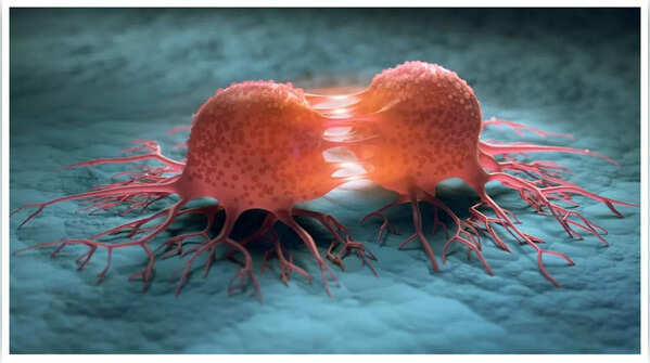 Woman experiencing pain during urination, potentially a sign of bladder cancer