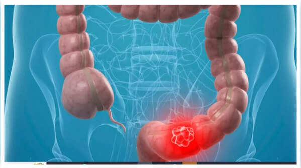 Illustration of abdominal discomfort