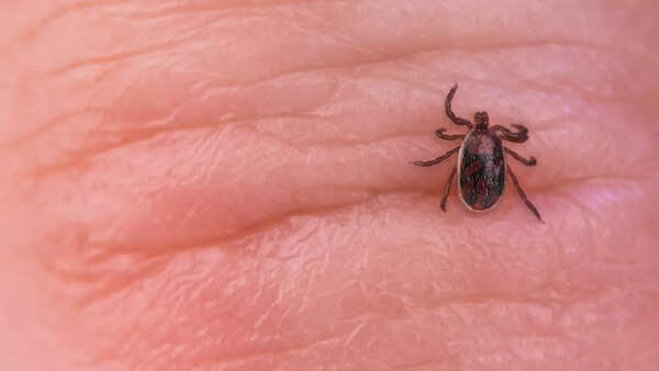 Close-up of a tick, a potential carrier of diseases like babesiosis.