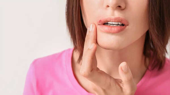 Recognizing sores that resist healing