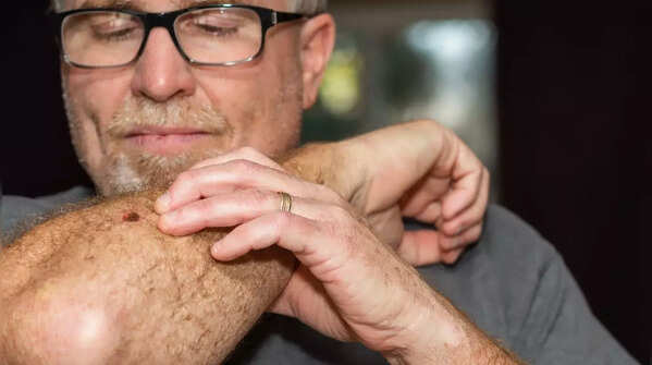 Examining skin for early signs of cancer