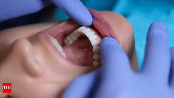Early signs of oral cancer